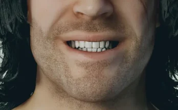 HD Teeth V1.0