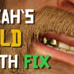 Micah's Gold Teeth Fix V1.0