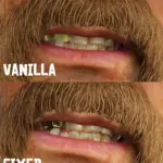 Micah's Gold Teeth Fix V1.0